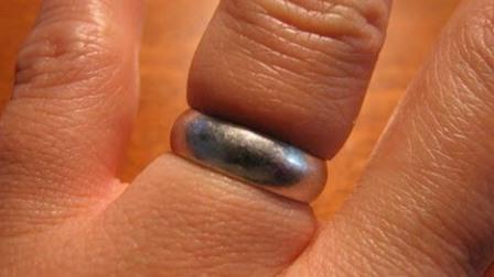 Tror du ringen må klippes av hvis ringfingeren hovner opp? – Se hvor enkelt du kan redde den.