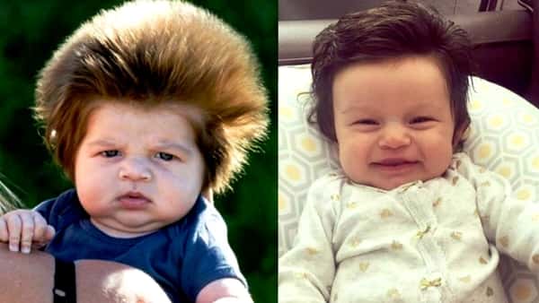Husker du babyen som sjarmerte alle med sitt unike hår? Her ser vi ham ett år senere!